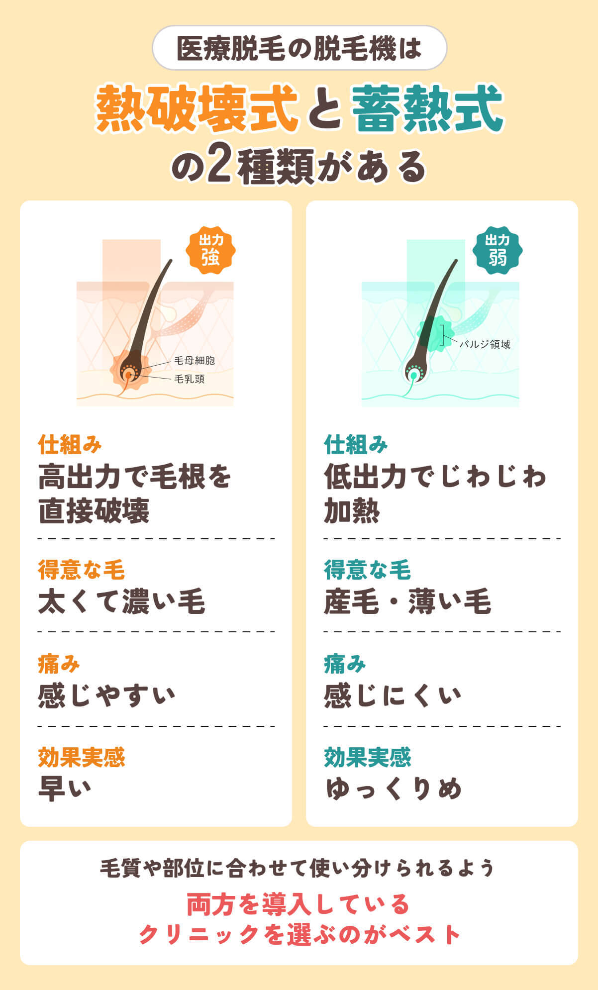 熱破壊式と蓄熱式